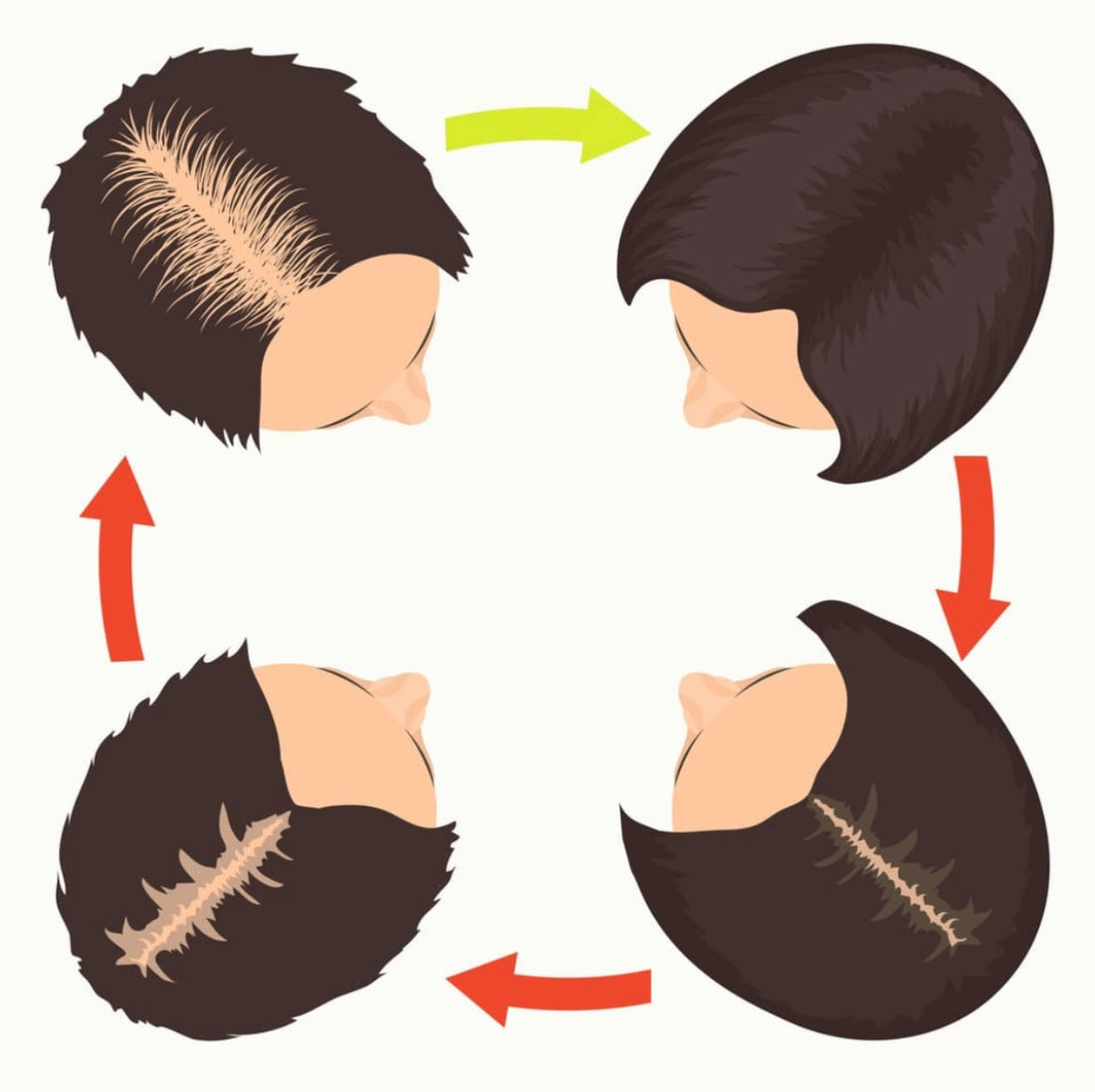Why You’re Losing Hair in Your 20s (and How To Stop It!)